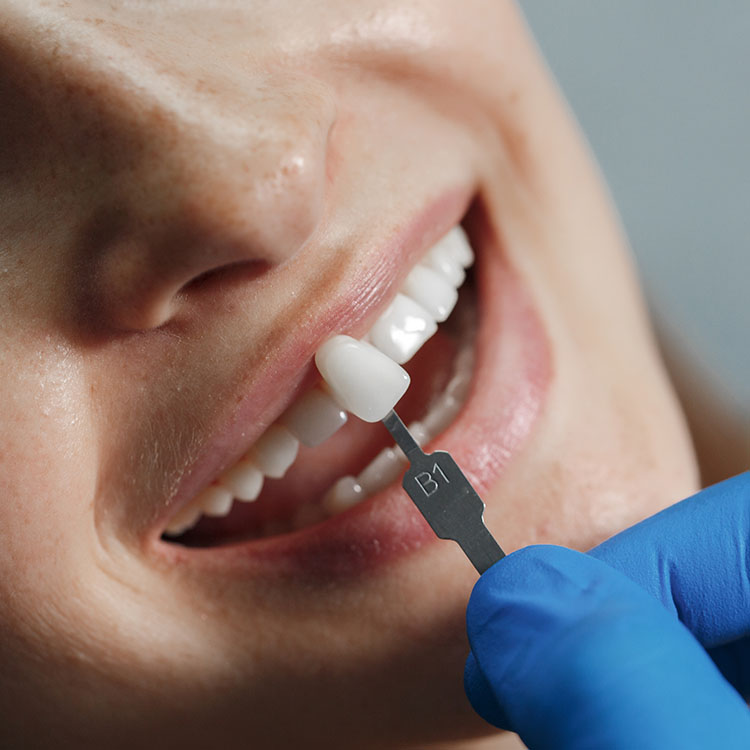 Protetyka stomatologiczna